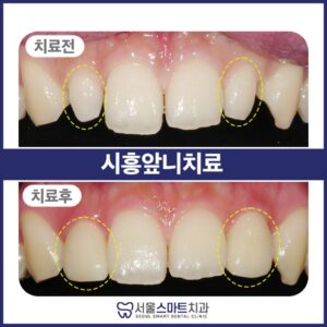 서울스마트치과