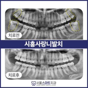 장곡동치과