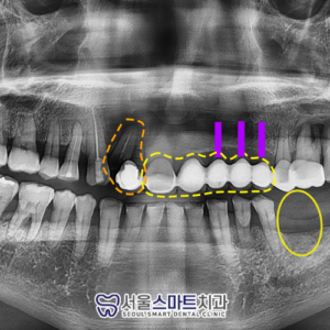 장현동치과