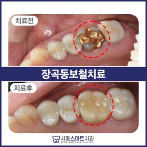 서울스마트치과