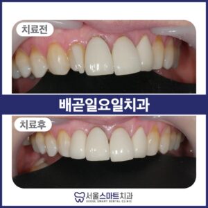 서울스마트치과