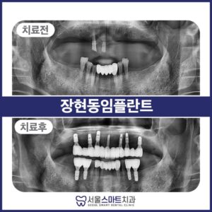 장현동치과