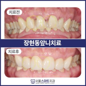 서울스마트치과