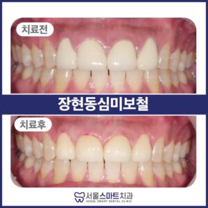 장현동치과