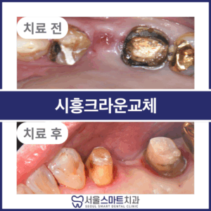 서울스마트치과