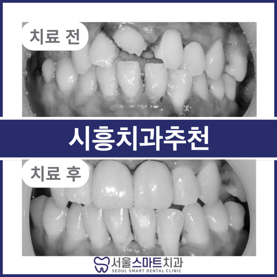 장현동치과 